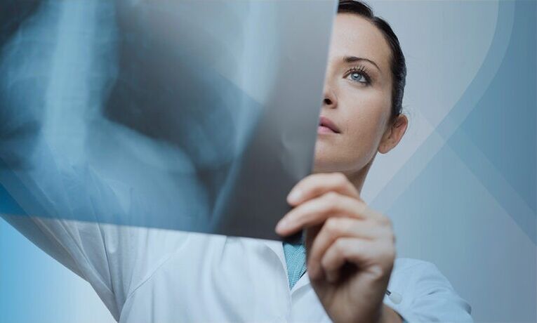 лекар разглежда моментна снимка на шийния отдел на гръбначния стълб с остеохондроза