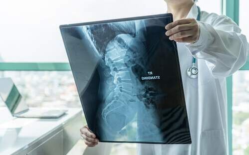 Рентгеновото изследване е необходим диагностичен метод, ако гърбът боли