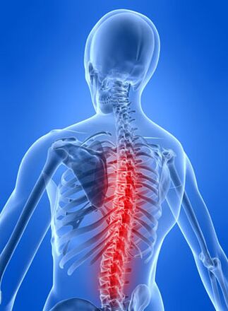 Болката е основният симптом на гръдна остеохондроза